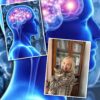 Scoperta neurologica: l’insula mostra connettività alterata in chi fa fatica a capire il parlato in ambienti rumorosi. Di Chiara Vergani