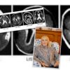 Il gene LIS1 e il suo ruolo fondamentale nello sviluppo cerebrale: nuove scoperte illuminano i disturbi neuroevolutivi. Di Chiara Vergani
